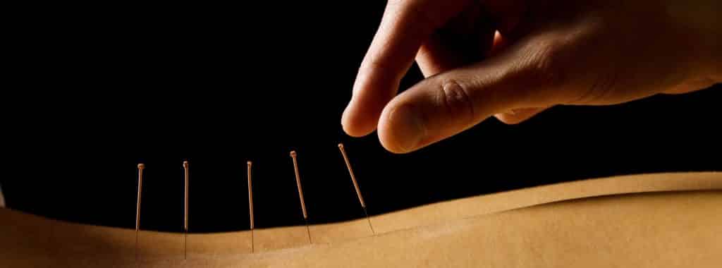 acupuncture for cancer